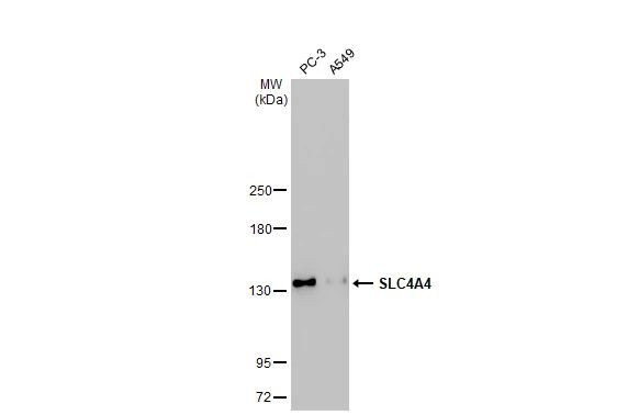 SLC4A4 Antibody in Western Blot (WB)