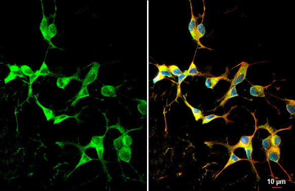 DRD2 Antibody in Immunocytochemistry (ICC/IF)