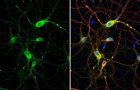 DRD2 Antibody in Immunocytochemistry (ICC/IF)