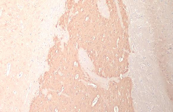 DRD2 Antibody in Immunohistochemistry (Paraffin) (IHC (P))