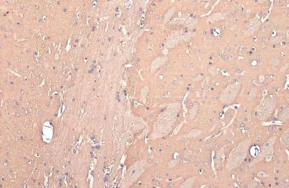 DRD2 Antibody in Immunohistochemistry (Paraffin) (IHC (P))