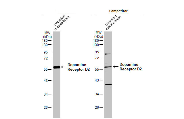 DRD2 Antibody in Western Blot (WB)