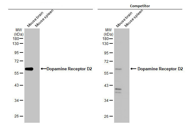 DRD2 Antibody in Western Blot (WB)