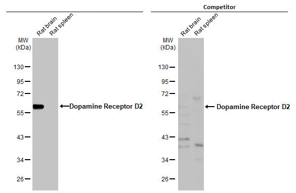 DRD2 Antibody in Western Blot (WB)