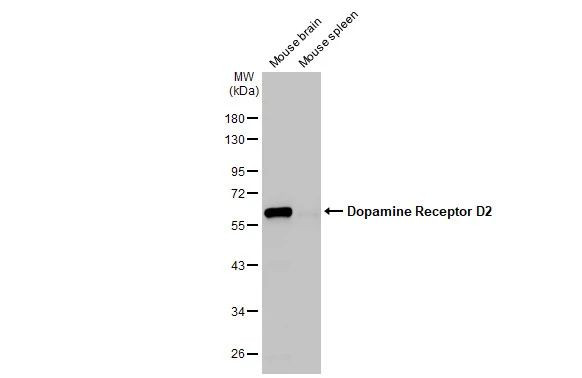 DRD2 Antibody in Western Blot (WB)