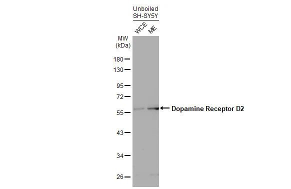 DRD2 Antibody in Western Blot (WB)