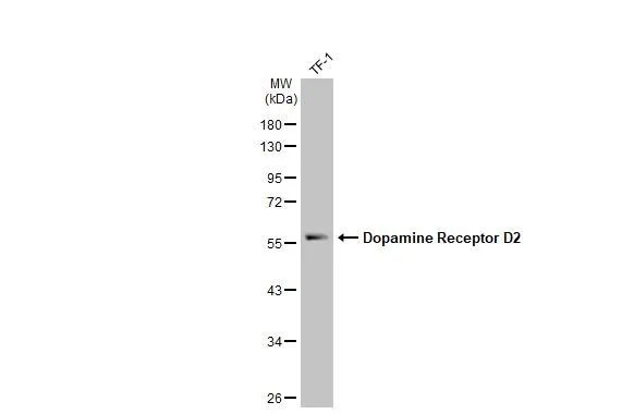 DRD2 Antibody in Western Blot (WB)