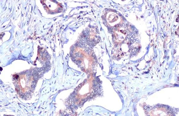 MUC4 Antibody in Immunohistochemistry (Paraffin) (IHC (P))