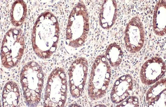 MUC4 Antibody in Immunohistochemistry (Paraffin) (IHC (P))