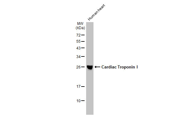 Cardiac Troponin I Antibody in Western Blot (WB)
