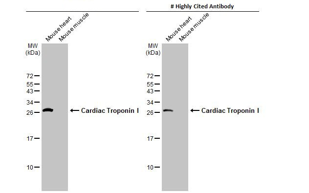 Cardiac Troponin I Antibody in Western Blot (WB)