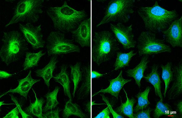 TOMM20 Antibody in Immunocytochemistry (ICC/IF)