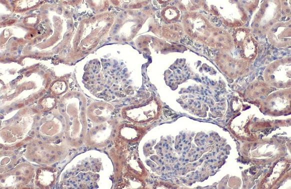 TOMM20 Antibody in Immunohistochemistry (Paraffin) (IHC (P))