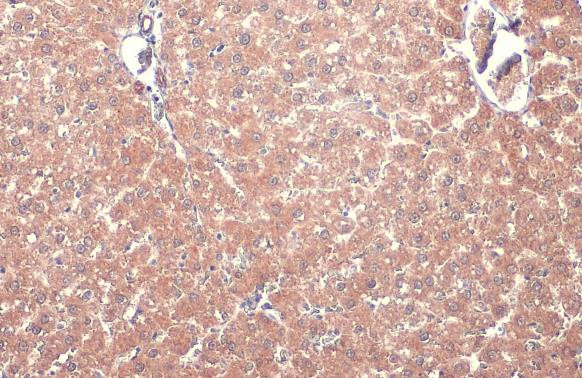 TOMM20 Antibody in Immunohistochemistry (Paraffin) (IHC (P))