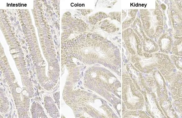 TOMM20 Antibody in Immunohistochemistry (Paraffin) (IHC (P))