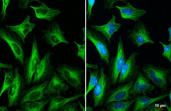 TOMM20 Antibody in Immunocytochemistry (ICC/IF)