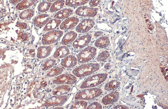 TOMM20 Antibody in Immunohistochemistry (Paraffin) (IHC (P))