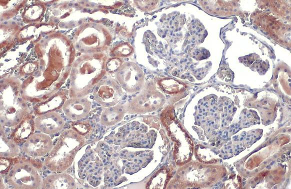 TOMM20 Antibody in Immunohistochemistry (Paraffin) (IHC (P))