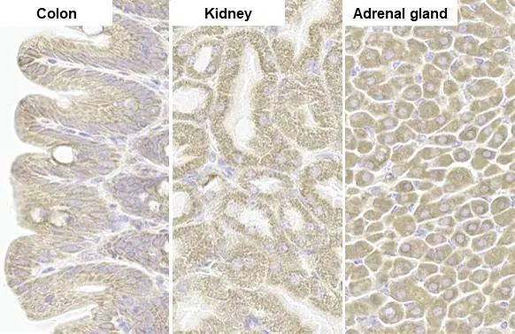 TOMM20 Antibody in Immunohistochemistry (Paraffin) (IHC (P))