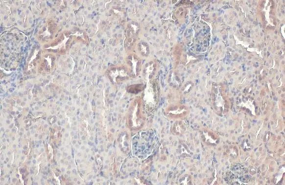 RAB5 Antibody in Immunohistochemistry (Paraffin) (IHC (P))