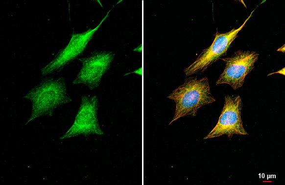 POLB Antibody in Immunocytochemistry (ICC/IF)