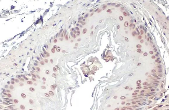 POLB Antibody in Immunohistochemistry (Paraffin) (IHC (P))