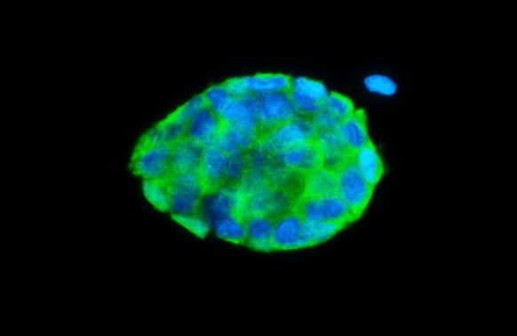 FABP4 Antibody in Immunocytochemistry (ICC/IF)