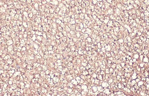 FABP4 Antibody in Immunohistochemistry (Paraffin) (IHC (P))