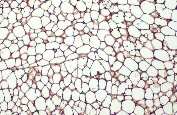 FABP4 Antibody in Immunohistochemistry (Paraffin) (IHC (P))