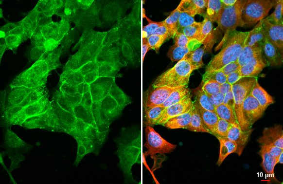 Claudin 3 Antibody in Immunocytochemistry (ICC/IF)