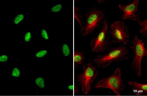 TRIM28 Antibody in Immunocytochemistry (ICC/IF)