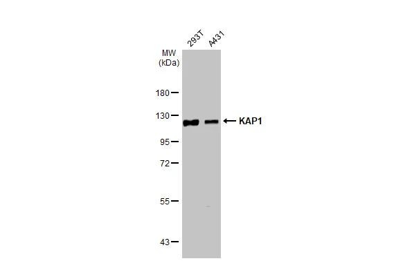 TRIM28 Antibody in Western Blot (WB)