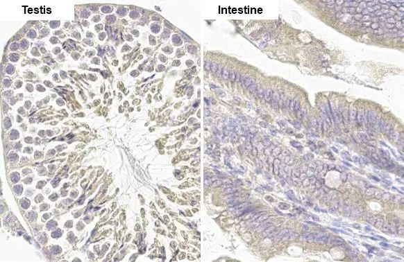 MCL-1 Antibody in Immunohistochemistry (Paraffin) (IHC (P))