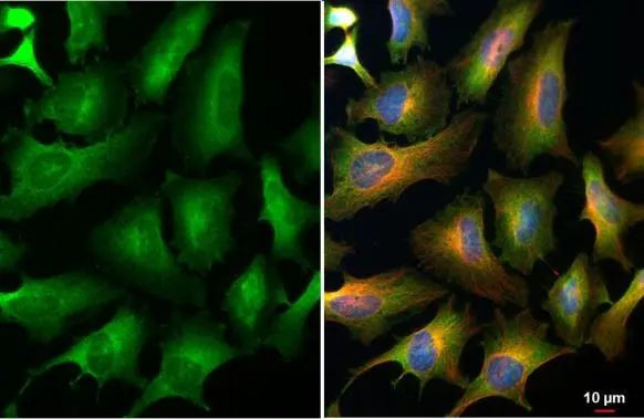 eIF4E Antibody in Immunocytochemistry (ICC/IF)