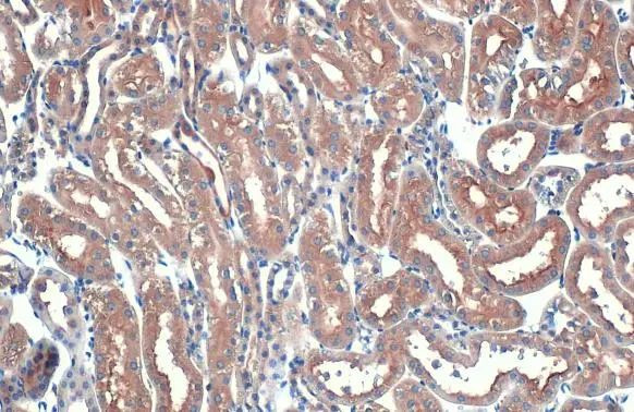 eIF4E Antibody in Immunohistochemistry (Paraffin) (IHC (P))