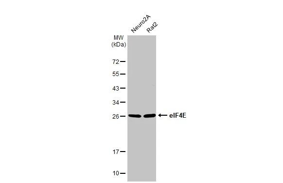 eIF4E Antibody in Western Blot (WB)