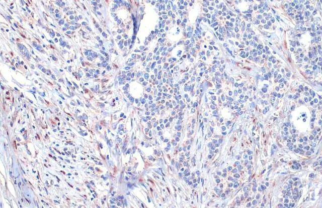 ADAM17 Antibody in Immunohistochemistry (Paraffin) (IHC (P))