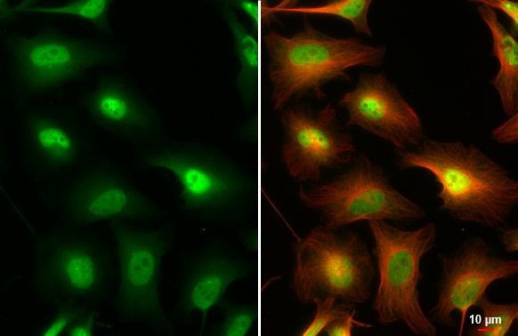 IKK gamma Antibody in Immunocytochemistry (ICC/IF)