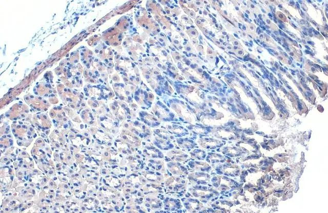 IKK gamma Antibody in Immunohistochemistry (Paraffin) (IHC (P))