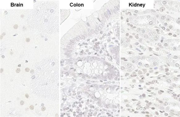 U2AF2 Antibody in Immunohistochemistry (Paraffin) (IHC (P))