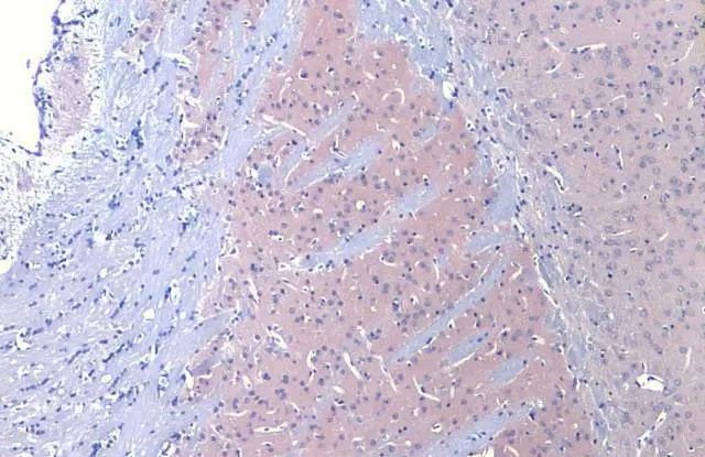 DRD2 Antibody in Immunohistochemistry (Paraffin) (IHC (P))