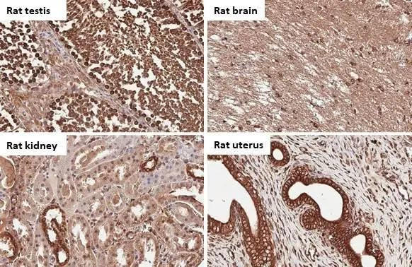 Calnexin Antibody in Immunohistochemistry (Paraffin) (IHC (P))