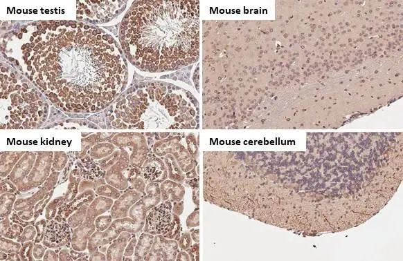 Calnexin Antibody in Immunohistochemistry (Paraffin) (IHC (P))