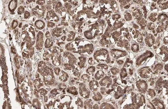 Calnexin Antibody in Immunohistochemistry (Paraffin) (IHC (P))