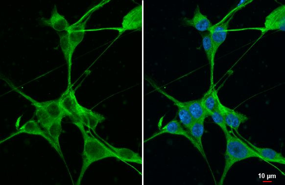 B-Raf Antibody in Immunocytochemistry (ICC/IF)