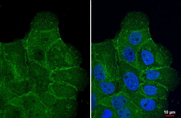 ASCT2 Antibody in Immunocytochemistry (ICC/IF)