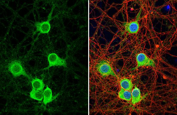 Synaptotagmin 1 Antibody in Immunocytochemistry (ICC/IF)