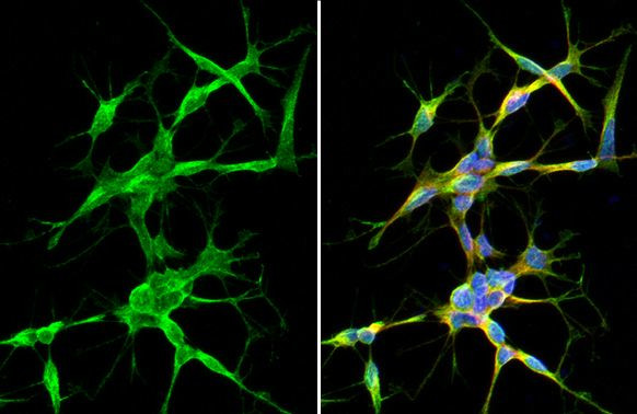 Synaptotagmin 1 Antibody in Immunocytochemistry (ICC/IF)