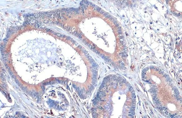 SCRIB Antibody in Immunohistochemistry (Paraffin) (IHC (P))