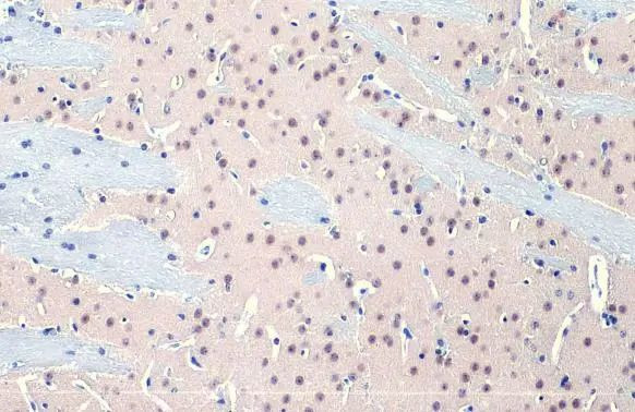 OGT Antibody in Immunohistochemistry (Paraffin) (IHC (P))